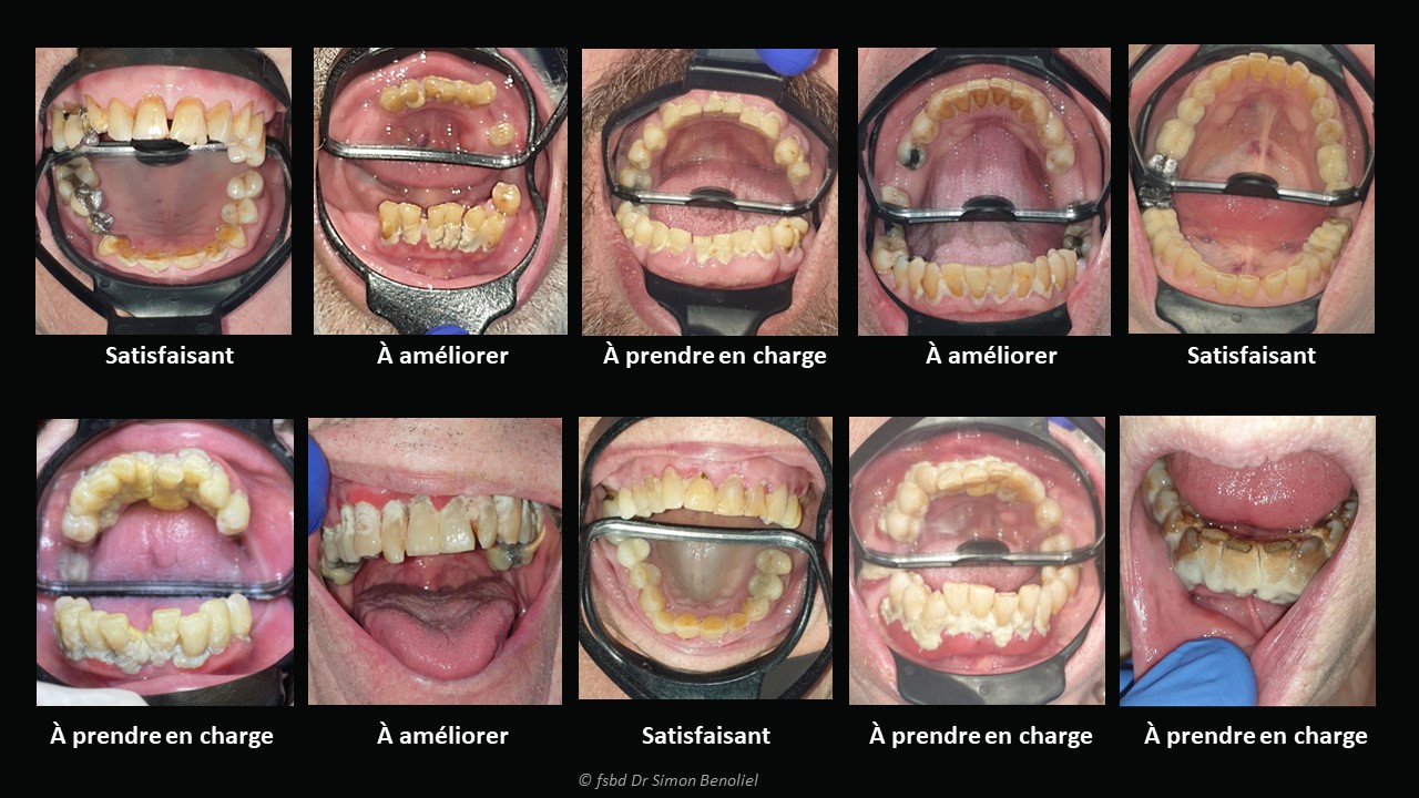 Images obtenues avec un odontoscope