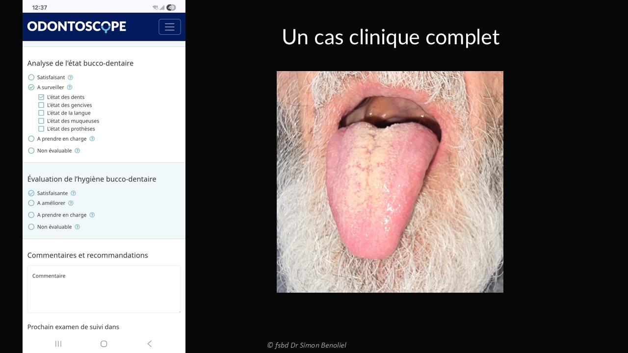 cas clinique langue